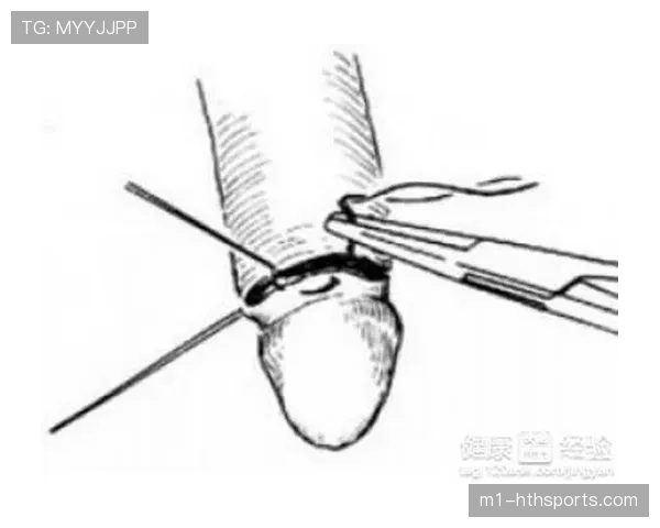 杰威手腕接受复查手术,预计两周后进行健康评估